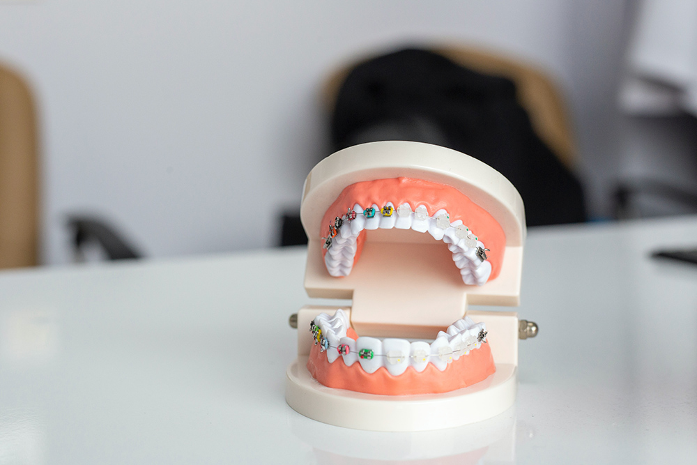 What Is An Orthodontist?