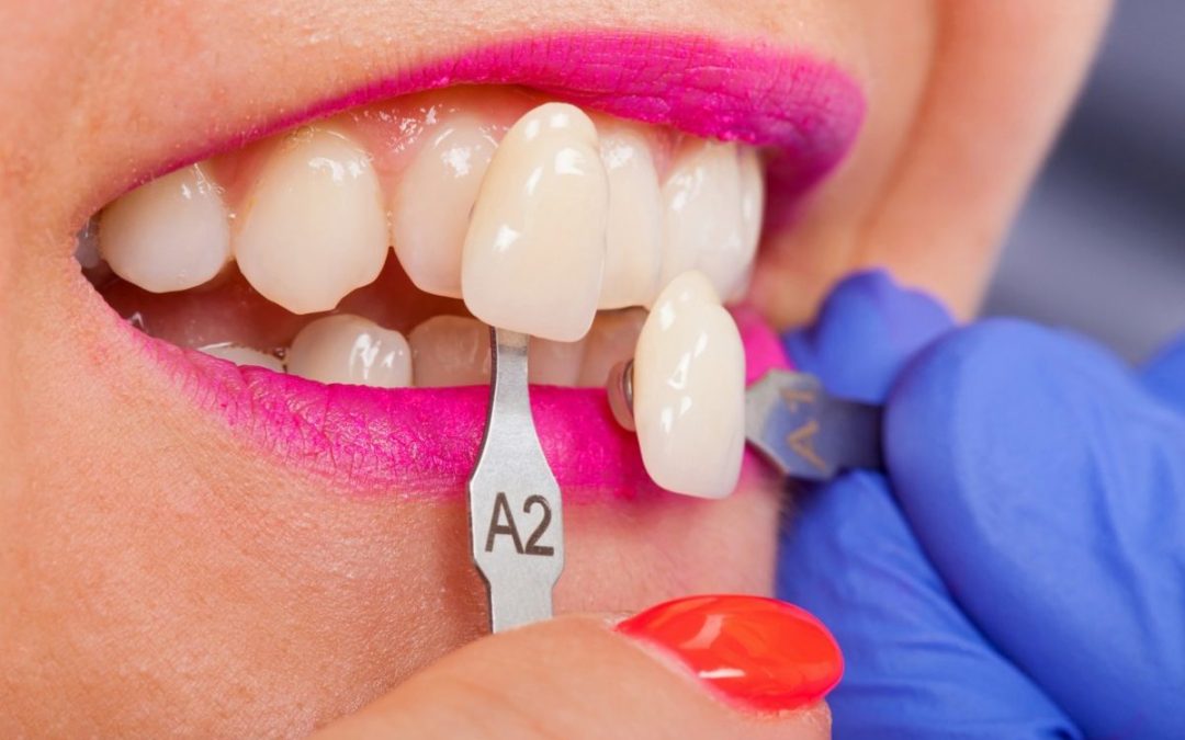 Unlocking the Beauty of Cosmetic Dentistry