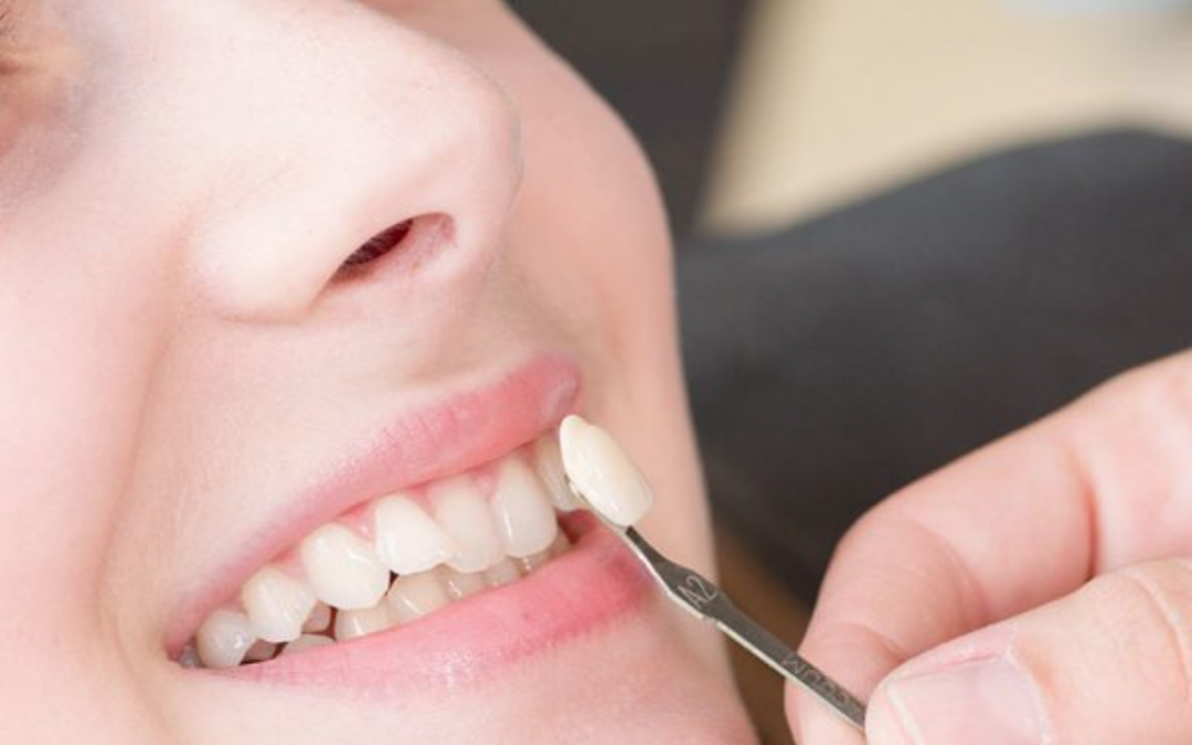 Brisbane’s Ten Best Dentists & Orthodontists: Healthy Reasons to Visit Queensland, Australia